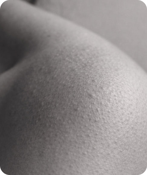 Open Pores & Uneven Finish