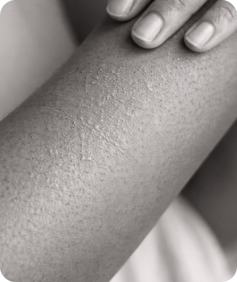 Sensitive & Easily Irritated Skin